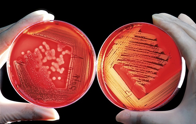 La carne albergar una variedad de microorganismos patógenos que representan riesgos para la salud ya que pueden causar enfermedades graves. 